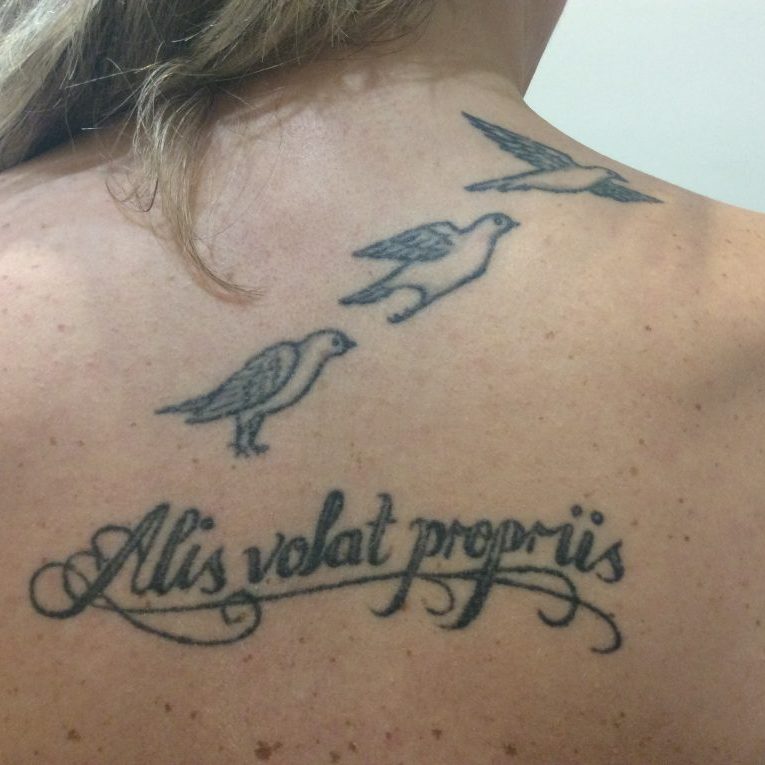 Laser tattoo removal before