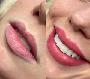 Lip Blush Tattoo