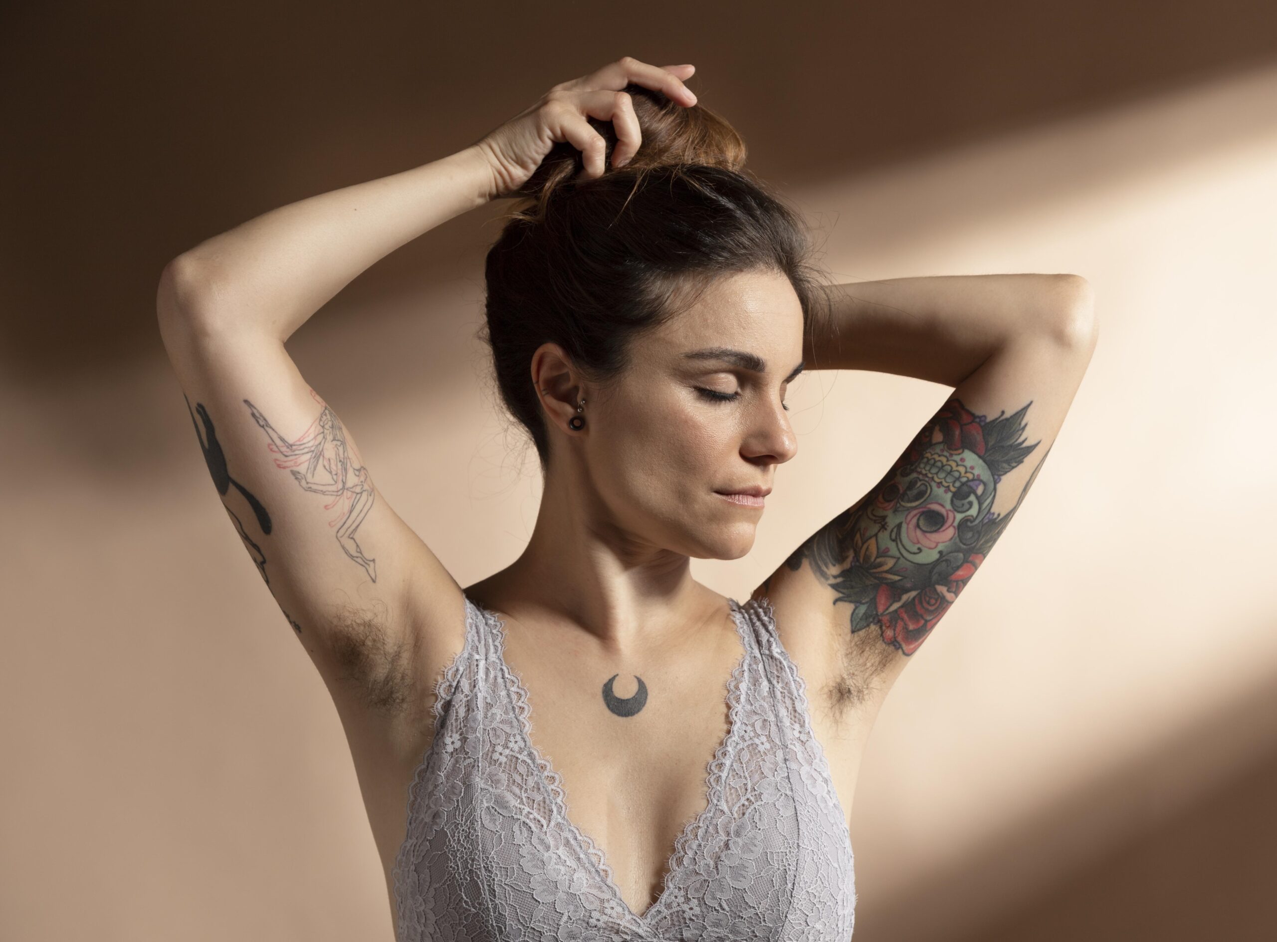 laser tattoo removal Bristol